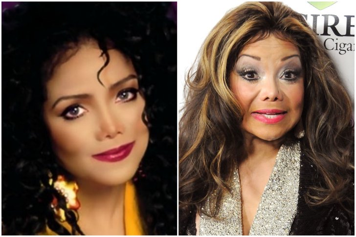 La Toya Jackson aesthetic surgery