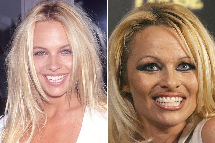 Pamela Anderson toxicomanie