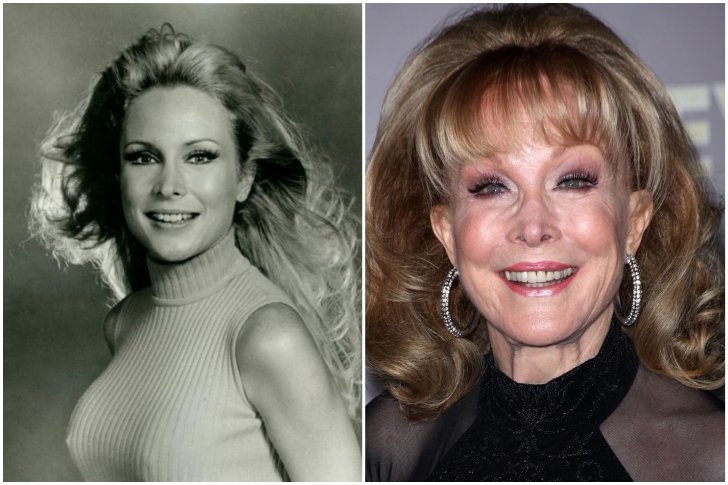 Barbara Eden chirurgie esthétique