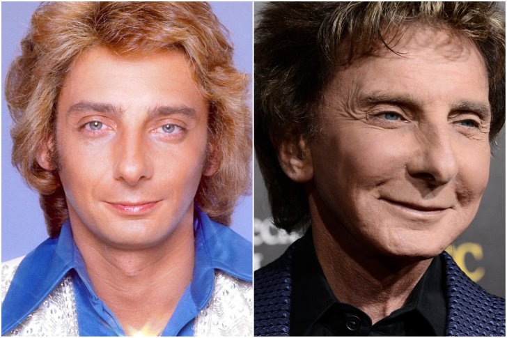 Barry Manilow chirurgie esthétique