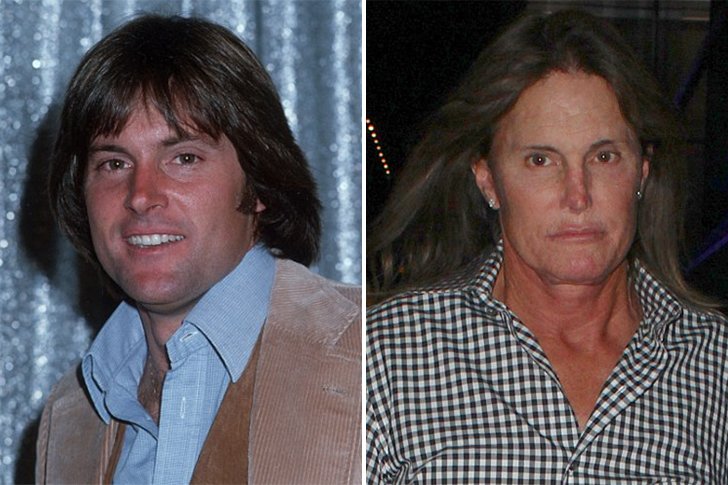 Changement de sexe de Bruce Jenner