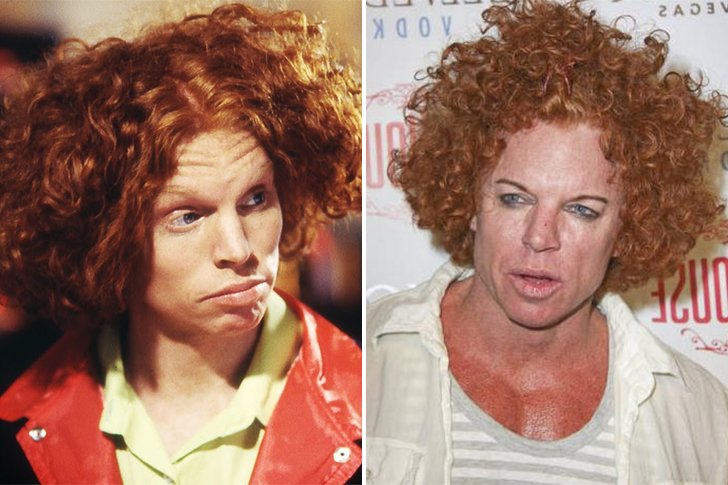 Chirurgie esthétique Carrot Top