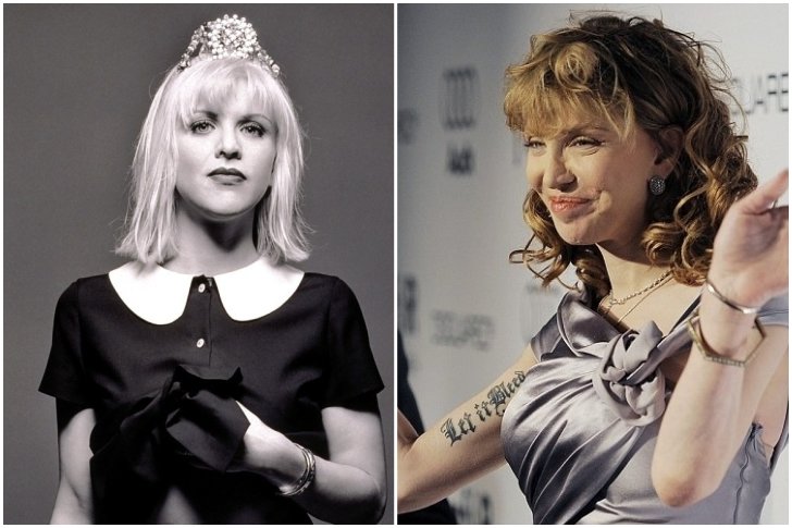 Courtney Love chirurgie esthétique