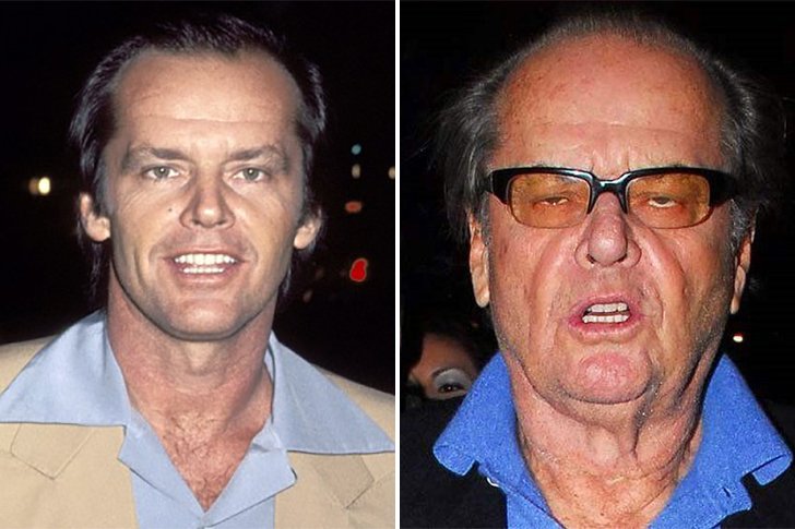 Jack Nicholson avant-après