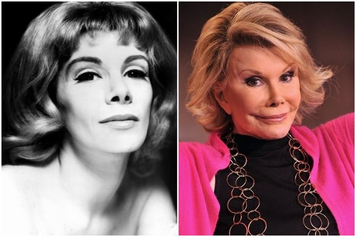 Joan Rivers chirurgie esthétique