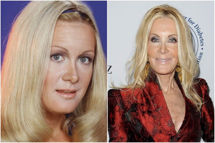 Joan Van Ark chirurgie esthétique