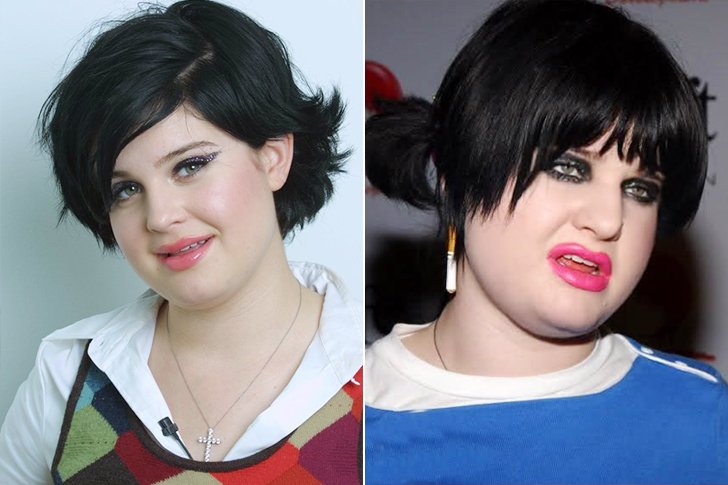 Kelly Osbourne toxicomanie