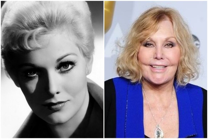 Kim Novak chirurgie esthétique