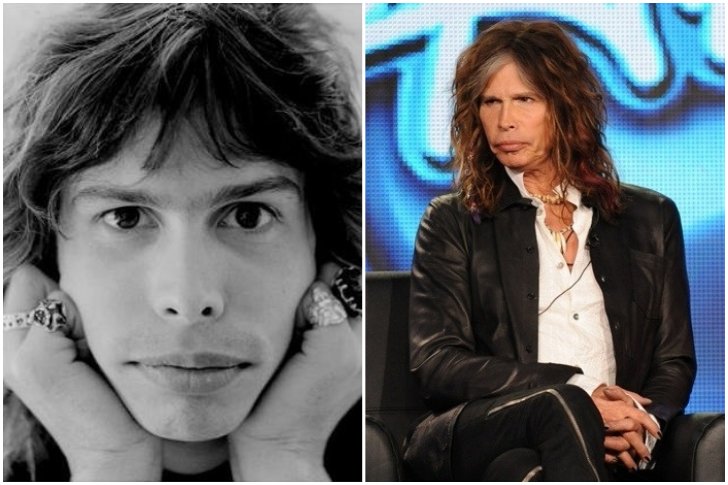 Steven Tyler aesthetic surgery