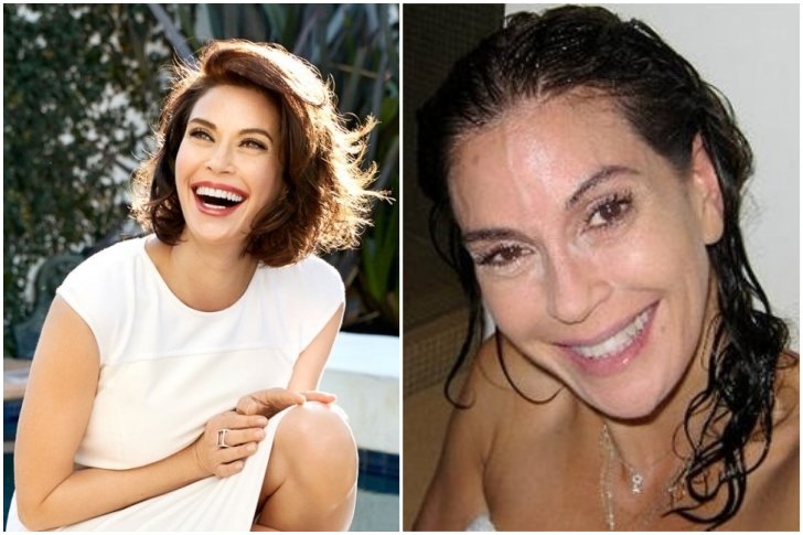 Teri Hatcher aesthetic surgery